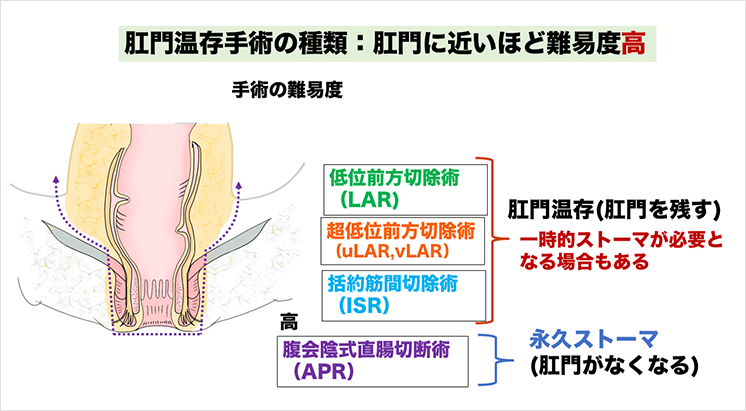 LARS（ラース）とは