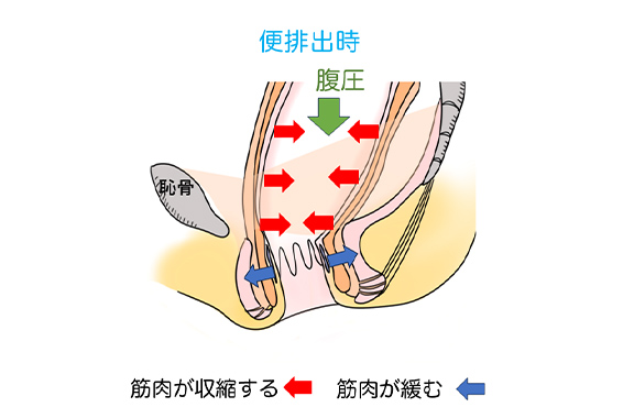 正しい排便姿勢